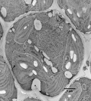 transmission electron microscopy dissertation